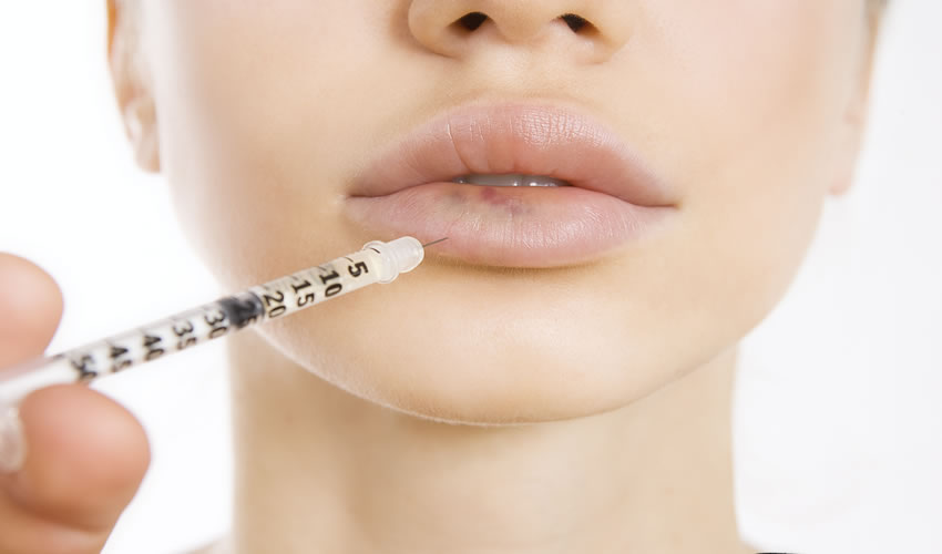 Comment vous assurer d’un aspect naturel lors de l’augmentation des lèvres