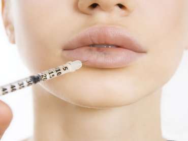 Comment vous assurer d’un aspect naturel lors de l’augmentation des lèvres